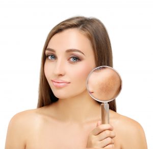 pigmentation