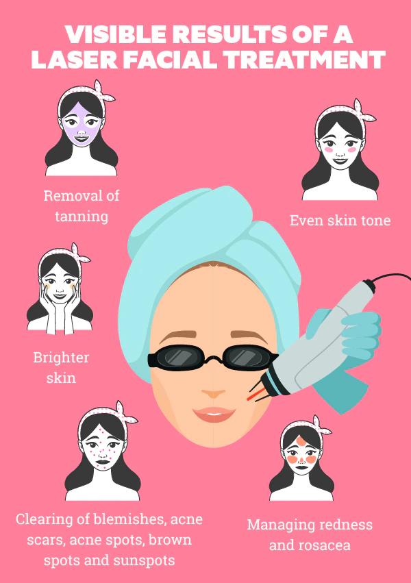 laser facial