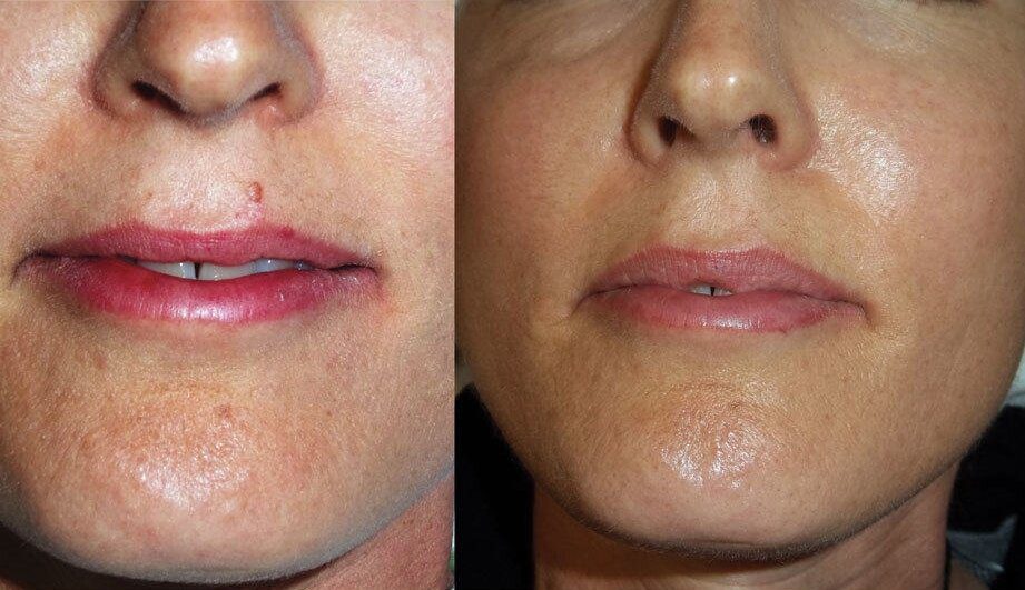 Medi-Facials