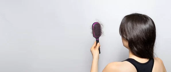 FPHL Treatment In Hyderabad  Solution for Hair Loss